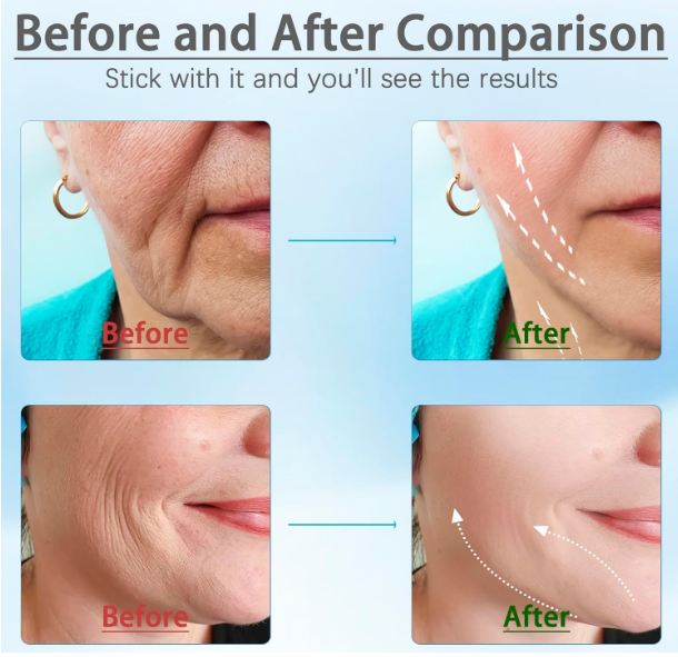 Face & Neck Firming Device — Lift, Tighten & Reduce Wrinkles