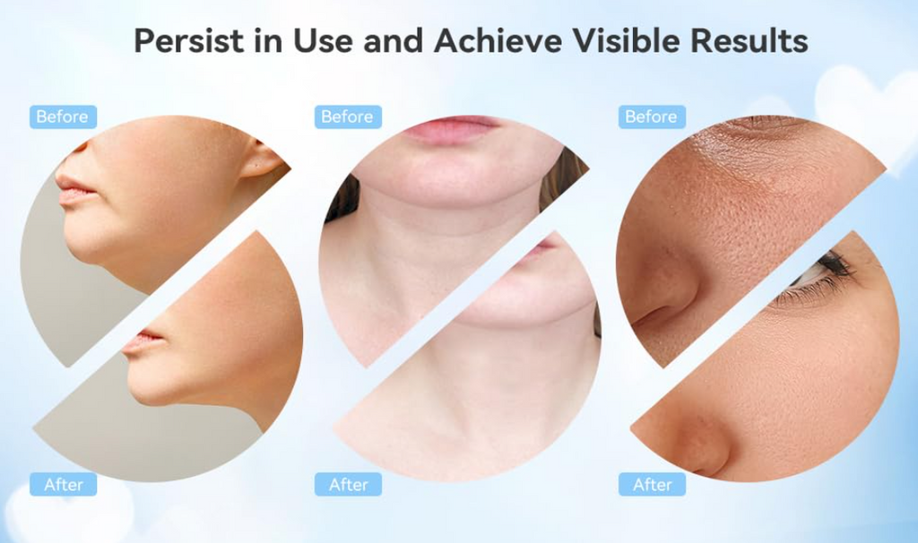 Electric Facial Cleansing Brush — 5-in-1 Skin Care Set