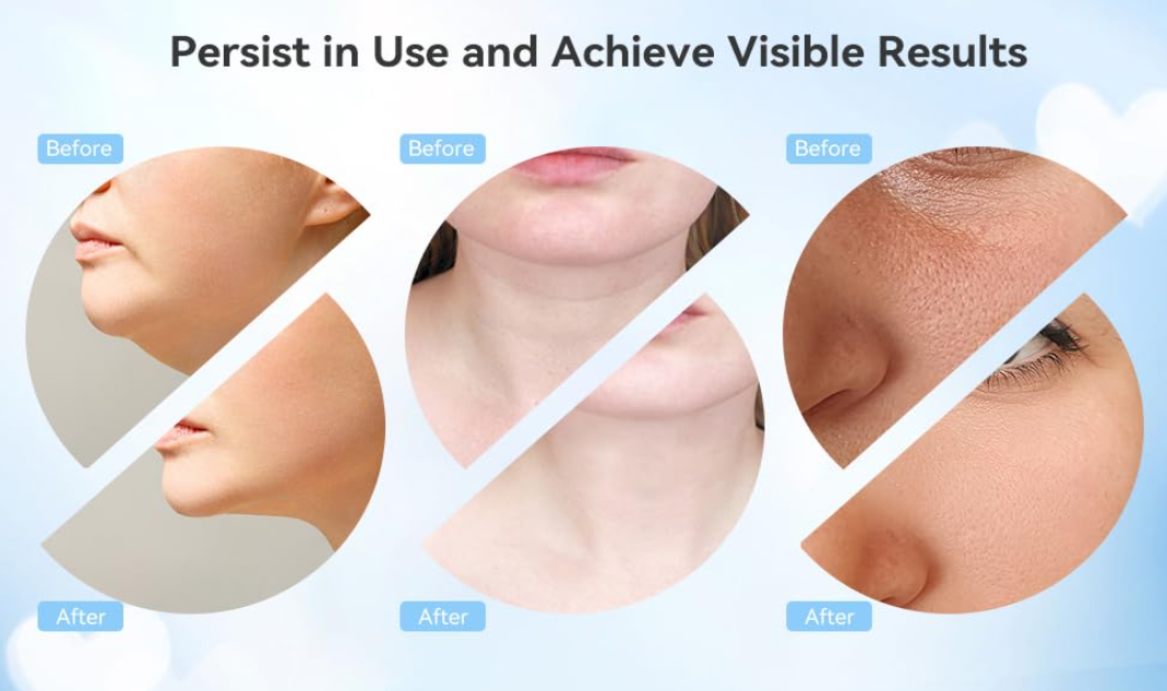Electric Facial Cleansing Brush — 5-in-1 Skin Care Set